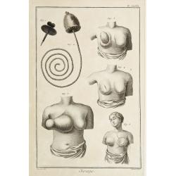 Chirurgie, plate XXVIII.